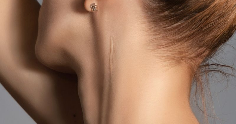 plastic surgeon treats scarring