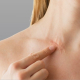 scar management