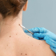 skin surgery in London
